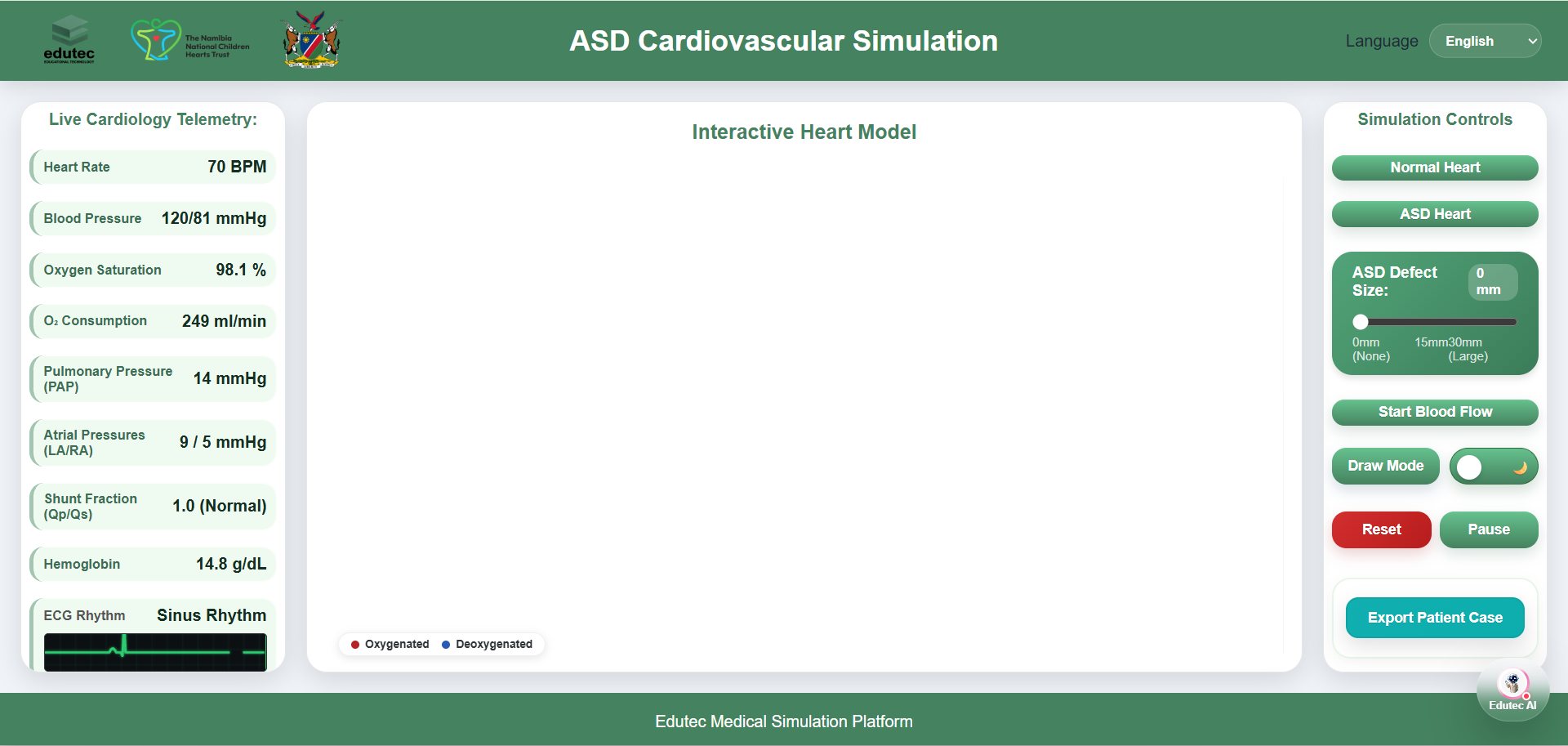 ASD-Cardiovascular-Simulation